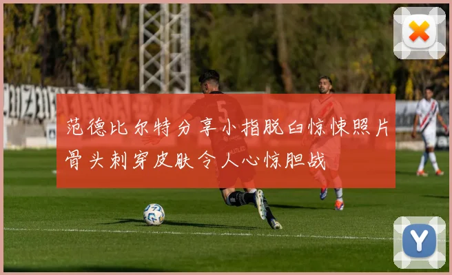 范德比尔特分享小指脱臼惊悚照片骨头刺穿皮肤令人心惊胆战